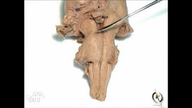 Videoaulas Uff Br Neuroanatomia Morfologia Externa Do Tronco Encef Lico