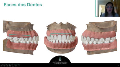 5 - Esclarecimento de Dúvidas - Anatomia Dental