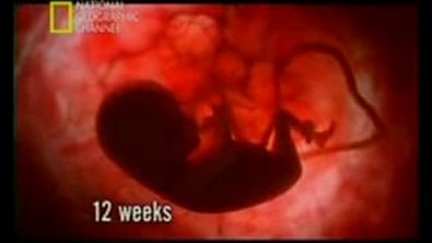 (08) Desenvolvimento Fetal 12º semana Vídeo