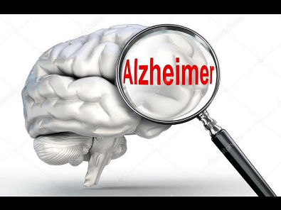 Descomplicando o Alzheimer