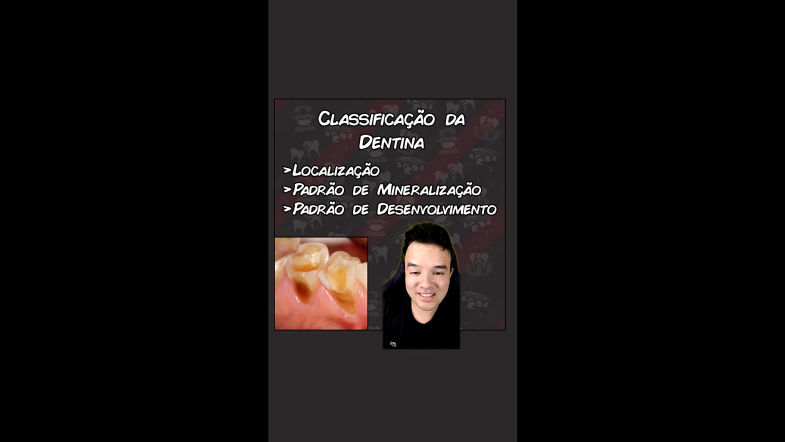 Classificação da Dentina - Primária, Secundária e Terciária - Resumo Concurso Odontologia