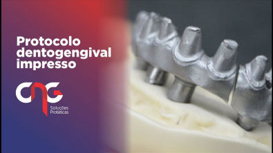 ESTUDO DE CASO - PROTOCOLO DENTOGENGIVAL IMPRESSO EM 3D