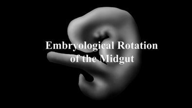 Embryological Rotation of the Midgut