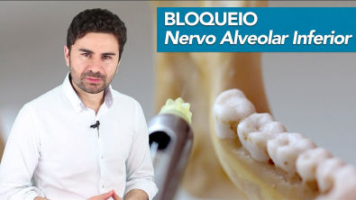 Bloqueio do Nervo Alveolar Inferior - PASSO-A-PASSO