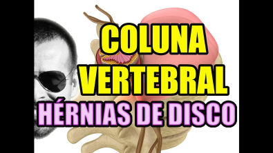 Vídeo Aula 114 - Anatomia Humana - Coluna Vertebral: Discos Intervertebrais e Hérnia de Disco