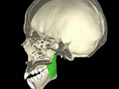 Anatomia aplicada 3d - Articulação temporomandibular