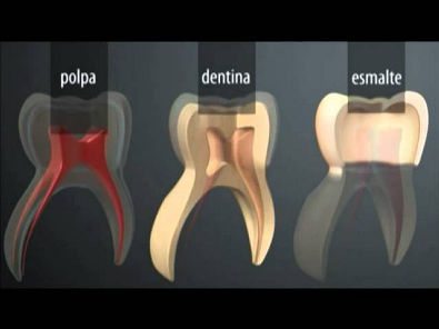 Dentição decídua e permanente