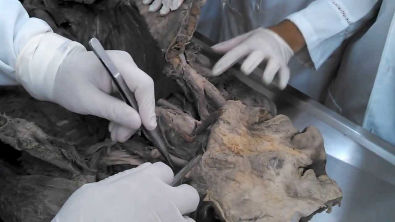 Anatomia Humana - Artérias