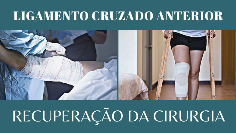 RECUPERAÇÃO DA CIRURGIA DE LIGAMENTO CRUZADO ANTERIOR.