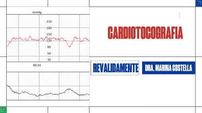 Cardiotocografia interpretação do exame