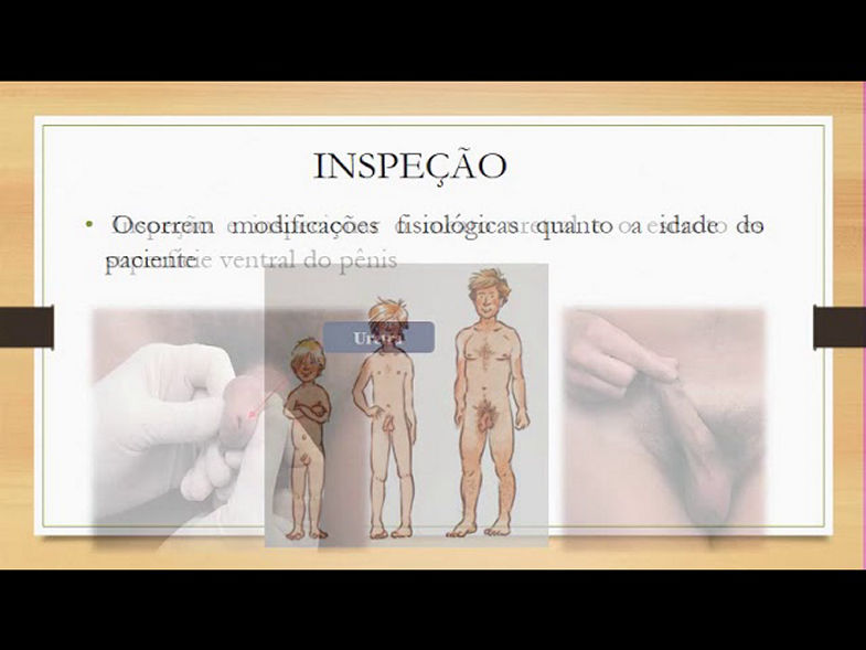 Exame físico das genitálias