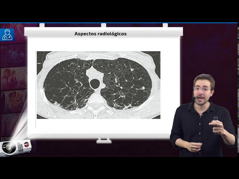 Doença Pulmonar Obstrutiva Crônica (DPOC) - Aula de Pneumologia SanarFlix