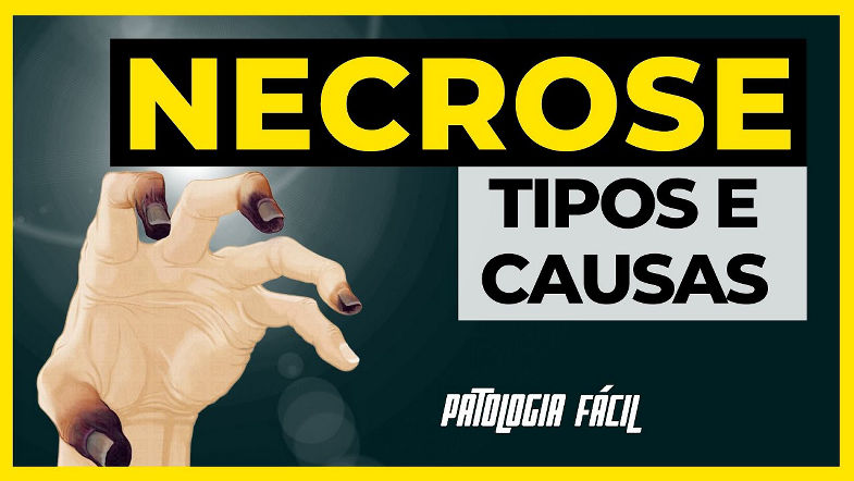 Necrose Patologia Coagulação, Liquefação, Caseosa, Gangrenosa, Gordurosa