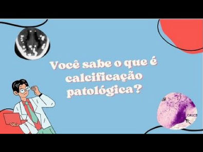Calcificações Patológicas - Patologia