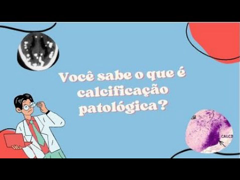Calcificações Patológicas - Patologia