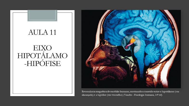 Videoaula 11 Eixo Hipotálamo Hipófise