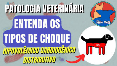 Tipos de choque Cardiogênico, Hipovolêmico e Distributivo - Fisiopatologia