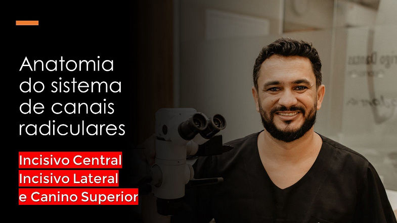 Incisivo central, Incisivo lateral e Canino superior - Anatomia do sistema de canais radiculares