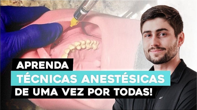 Guia Completo Técnicas Práticas de Anestesia em Odontologia