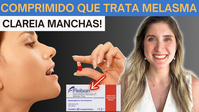 FLEBON para Melasma Benefícios para a Pele- [Dermato Ensina Como Usar]