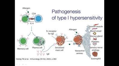 Hipersensibilidades (1/5): Tipo I - Alergias
