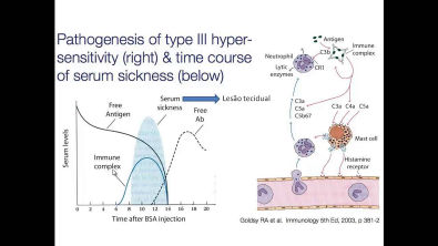 Hipersensibilidades (3/5): Tipo III - Mediado por imunocomplexos