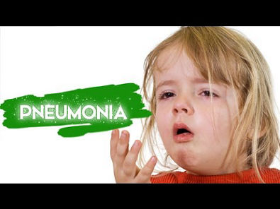 PEDIATRIA - Pneumonia Bacteriana Infantil