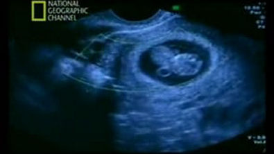 07-10semana-desenvolvimento do feto semana a semana