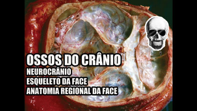 Ossos do Crânio: Neurocrânio e Esqueleto da Face - Anatomia Humana - VideoAula 136 -