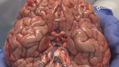 CÉREBRO HUMANO- Anatomia do Sistema Nervoso