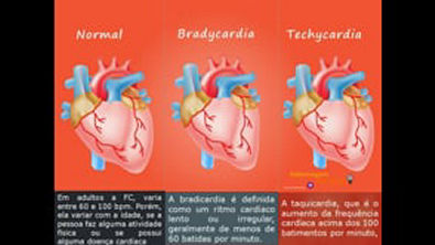 Ritmos Cardíacos ( Normal, Bradicardia e Taquicardia ) MINUTOS DE CONHECIMENTO ?