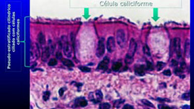 Tecido epitelial glandular   parte 33