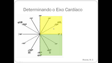 Determinação do Eixo Cardíaco (Eletrocardiograma)