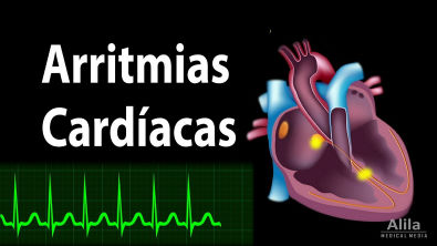 Arritmias Cardíacas, Animação. Alila Medical Media Português