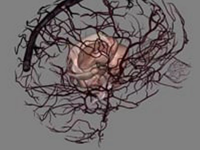 Anatomia do cérebro dissecado....   Histologia, Fisiologia Anatomia Humana
