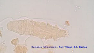 Demodex folliculorum (canis) ♂