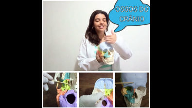 Vídeo- Aula Prática ossos do cranio e pontos craniométricos