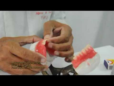 Prótese dentária montagem Prof. Almir de Souza