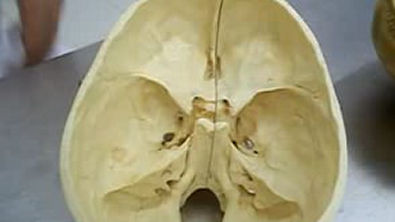 Estruturas internas do Crânio (1)