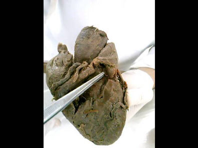 CaduAnatomia - Coração (parte 1)