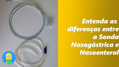 Entenda as Diferenças entre a Sonda Nasogástrica e a Sonda Nasoenteral