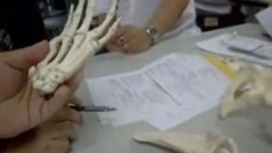 Osteologia  Acidentes Ósseos   Ossos da Mão e Dedos