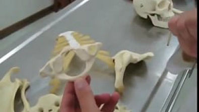 anatomia acidentes ósseos (excelente) part 2
