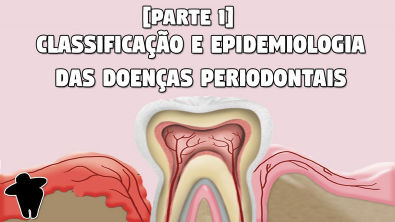 Classificação e Epidemiologia das Doenças Periodontais - Concursos Para Dentistas [DE #6 PT1]