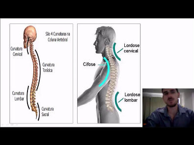 Alterações posturais da coluna vertebral