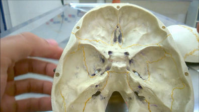 Neuroanatomia - Forames Cranianos