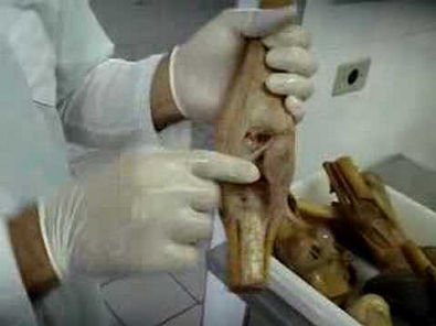 Anatomia A2 - artrologia