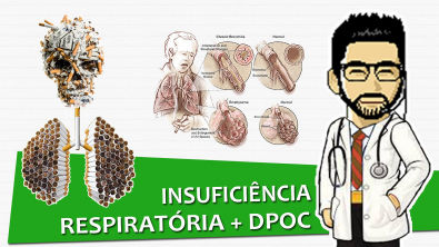 #MR Insuficiência Respiratória + DPOC