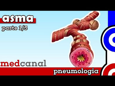Asma I (Definição, quadro clínico, diagnóstico) | PNEUMOLOGIA