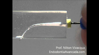 Instrumentação Endodôntica Manual - Prof Nilton Vivacqua